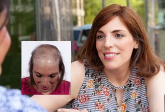 Womens hair loss replacement Richmond VA