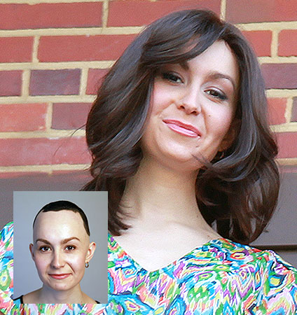 Medical Wigs for Alopecia, Chemotherapy & Trichotillomania